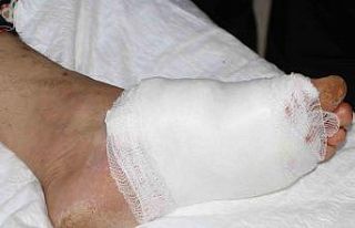 Diyarbakır’daki yanık ünitesi, kronik yara birimi...