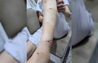 İBB Başkan danışmanı Murat Ongun’un köpeği...