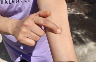 Böcekler, önce evlerini sonra vücutlarını istila...