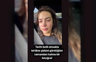 Ece Ronay’a eski eşinden şiddet