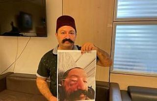 Sosyal medya fenomeni, ev sahibi tarafından darp...