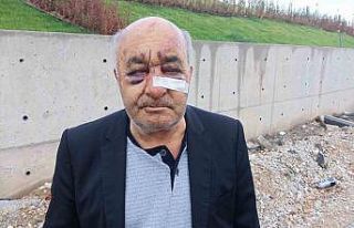 Öldüresiye dövülen taksici korku dolu o anları...