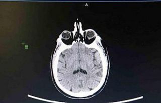 KBB Uzmanı Prof. Dr. Sakallıoğlu: "İşitme...