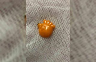 Elazığ’da 9 aylık bebeğin boğazına kaçan...