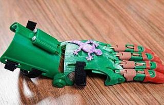 Büyükşehir çocuklara robot el ile umut olacak