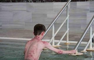 Tedavisi mümkün olmayan hastalığa bu su şifa...