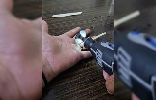 Vatandaşın parmağına sıkışan yüzük kesilerek...