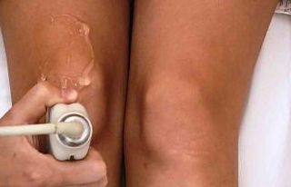 Diz kireçlenmesine bebeklerin göbek kordonuyla tedavi