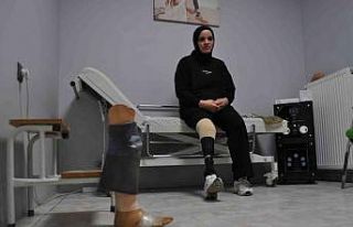 Bantlı kırık protezle çalışıp 4 çocuğuna...