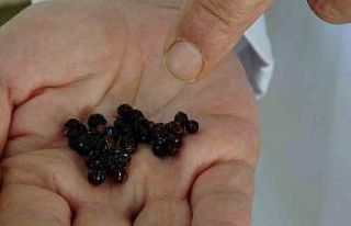 Dünyada en çok görülen kanserlerden kolon kanserine...