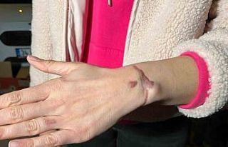 Esenyurt’ta güzellik merkezinde dövme sildirme...