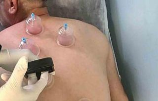 Genç Devlet Hastanesinde hacamat polikliniği hizmete...