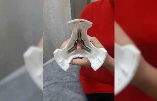 Parmağını zeytin çizme aparatına kaptıran çocuğun...