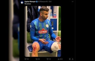 Çaykur Rizespor, Rachid Ghezzal’ın darbe alan...