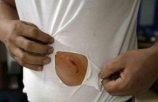 Çerkezköy’de fabrika işçisi köpeklerin saldırısından...