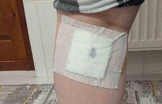 Sokak köpekleri anne ve oğluna saldırdı