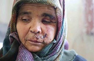 Kızlarının evine ziyarete giden anne ve baba köpeğin...