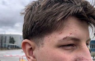 Transpaletin altında kalan öğrenci konuştu: “Normalde...