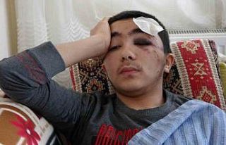 Başıboş köpeklerden kaçarken düşen 16 yaşındaki...