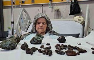 Görenler şok oldu: 92 yaşındaki kadının midesinden...