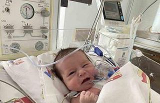 Minik kalbe büyük operasyon, 12 günlükken yapılan...