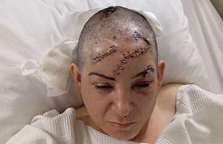 Nevşehir’de eşinin satırla ağır yaraladığı...