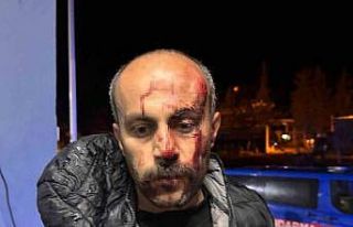 Şanlıurfa’da müvekkilinin yanına giden avukata...