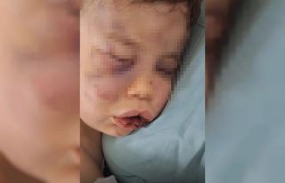 Vahşeti yaşayan 2 yaşındaki bebek hastanelik oldu