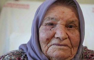 Dört mevsim gözyaşı yağmuru, bir cerrahiyle güneşle...