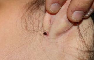 Havaların ısınmasıyla birlikte kenelerle temas...