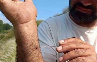 Uzmanı uyardı: "Kenenin vücutta kalma süresi...