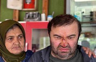 Yüzde 90 engelli vatandaş acımasızca darp edildi