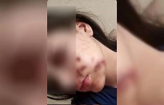 Yüzüne maytap isabet eden genç kız yaralandı