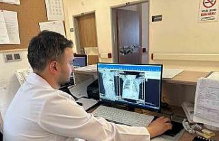 Çekirdek kabukları yutması sonucu nefessiz kalan...