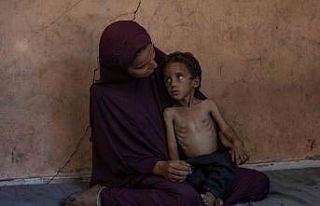 Gazze’de açlık nedeniyle hayatını kaybedenlerin...