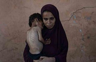 Gazze’de açlık nedeniyle hayatını kaybedenlerin...