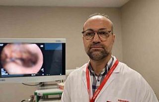 Mide küçültme tercihinde yeni yöntem ameliyatsız...