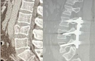 Yüksekten düşen hasta, Patnos’ta ilk kez uygulanan...