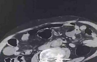 Cinsel organında Denizli’ye uyuşturucu sokmak...