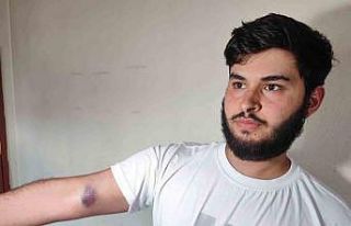 Conolar hem topu vermedi hem de aileye sopalı silahlı...