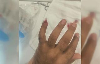 Uyuşturucuyla yakalanan şüpheli, polisin parmağını...