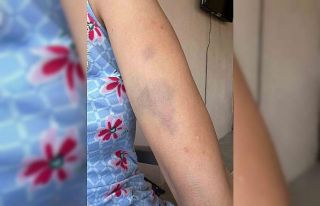 Veteriner ve ailesine ‘Sokak köpeklerini besledin’...