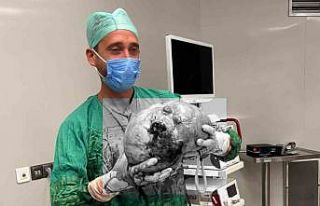 Yozgat’ta bir hastadan karpuz büyüklüğünde...