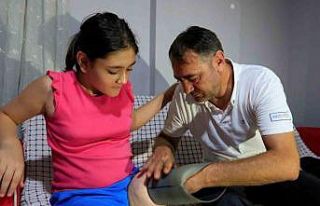 Protez bacağı dar gelen Özge için Türkiye ayağa...