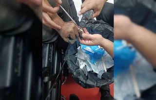 Parmakta sıkışan yüzük, hastanede doktor ve itfaiye...