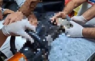 Tel Abyad’ta elini kıyma makinesine kaptıran çocuk...