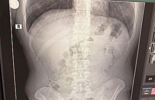 Uşak’ta midelerinden uyuşturucu çıktı: İranlı...