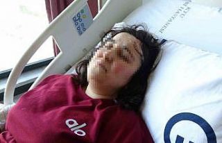 Boşanma aşamasındaki kocasından bıçaklı saldırıya...