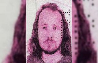 İngiliz vatandaşı, Türkiye’de saç ekimi ve...