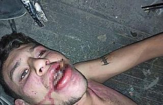 Hamam böceği yedirilen gencin dosyasında karar:...